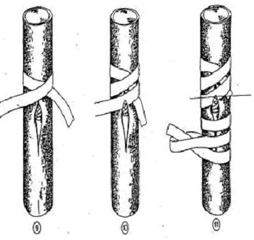 Entmaterialen Entbandjes / Zetbandjes